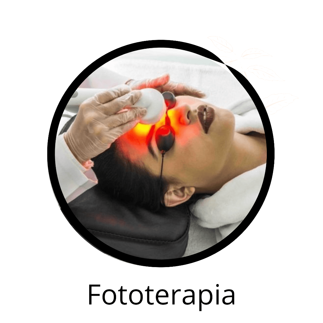 Fototerapia