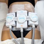 Artix Combo Full - Criolipólise de Placas + Mesa