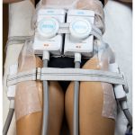 Artix Combo Full - Criolipólise de Placas + Mesa