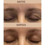 Aurius Plasma - Aparelho Jato de Plasma HTM