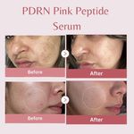 Medicube - Pdrn Pink Peptide Serum 