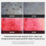 Medicube Red Succinic Acid Panthenol Facial Peeling Pads