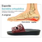 Sandália Ortopédica Feminina Para Esporão Joanete Zebra Nb03