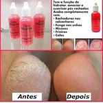 Gota Milagrosa Hidratante Combate a Rachadura nos Pés Natty Vida 30ml kit 12 unidades