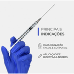 Smart Microcânula – 22G x 70 mm – Cx 10 unid | Smart GR