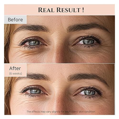 Beauty Of Joseon - Revive Eye Serum Giseng + Retinal