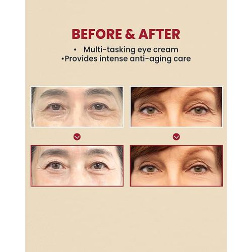 KSECRET SEOUL 1988 Eye Cream – Retinal Liposome 4% + Fermented Bean