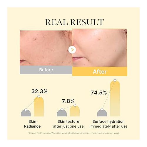 Medicube Kojic Acid Turmeric Brightening Gold Jelly Gel Mask