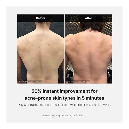 Medicube Red Acne Body Wash