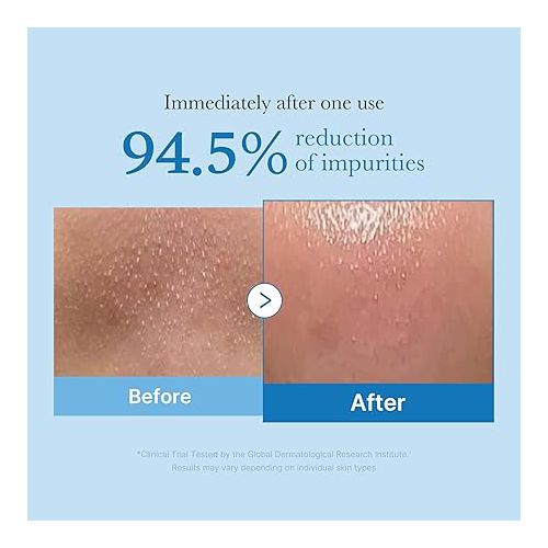 MEDICUBE ZERO PORE BLACKHEAD DEEP CLEANSING OIL 