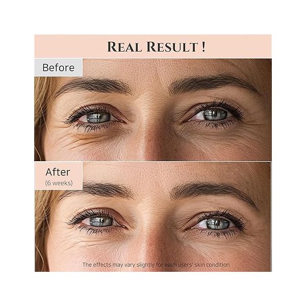 Beauty Of Joseon - Revive Eye Serum Giseng + Retinal