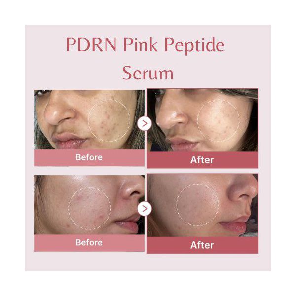 Medicube - Pdrn Pink Peptide Serum 