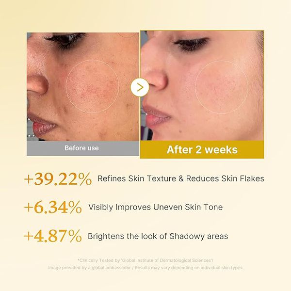 Medicube Kojic Acid Turmeric Smoothing Toner for Face & Body