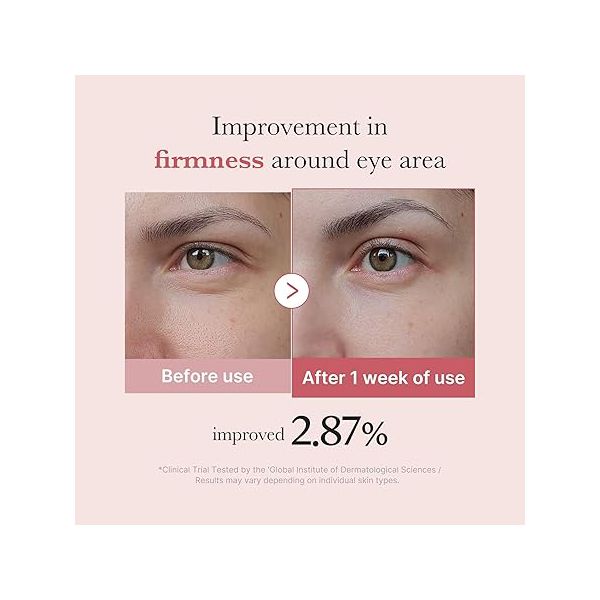 Medicube Salmon DNA PDRN Pink Peptide Eye Serum with Niacinamide and 99% Purity Retinol for Fine Lines