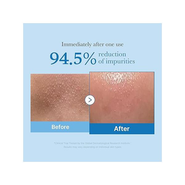 MEDICUBE ZERO PORE BLACKHEAD DEEP CLEANSING OIL 