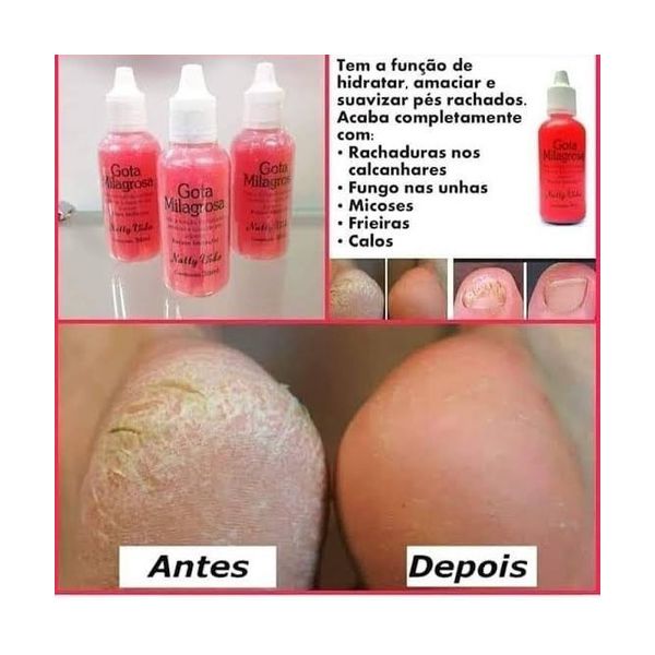 Gota Milagrosa Hidratante Combate a Rachadura nos Pés Natty Vida 30ml kit 12 unidades