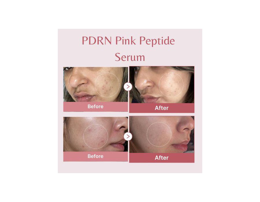 Medicube - Pdrn Pink Peptide Serum 
